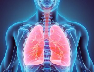 medical malpractice failure to diagnose pulmonary embolism