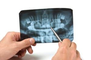 dental malpractice lawyers