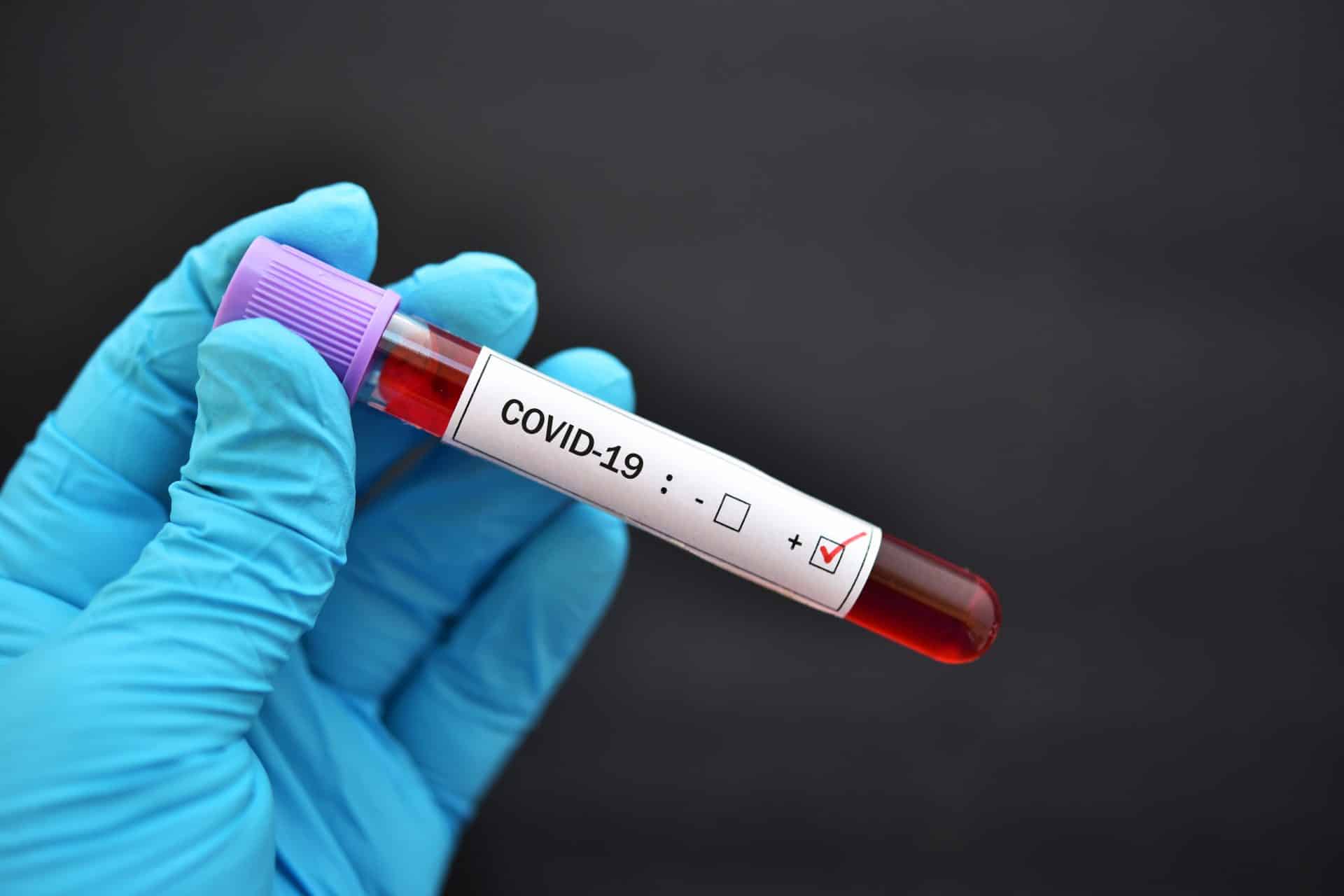 Can NYC Residents Who Caught COVID-19 in Their Apartment Sue?