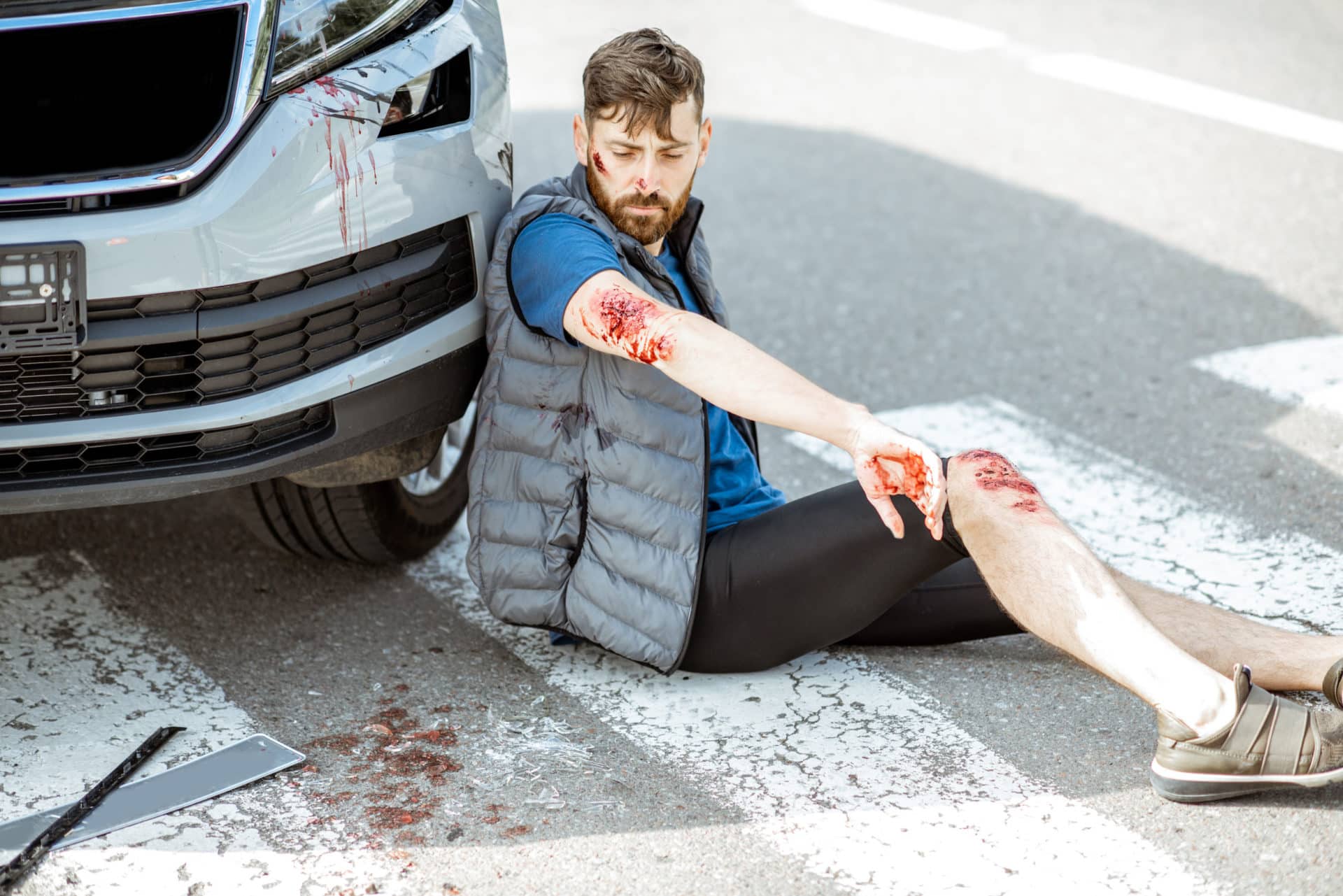 What Happens When the NYC Driver Who Injured Me Dies?