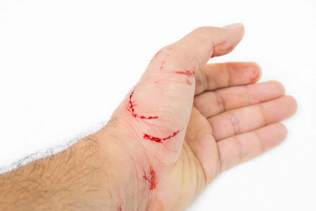 Filing a Dog Bite Injury Claim in New York City